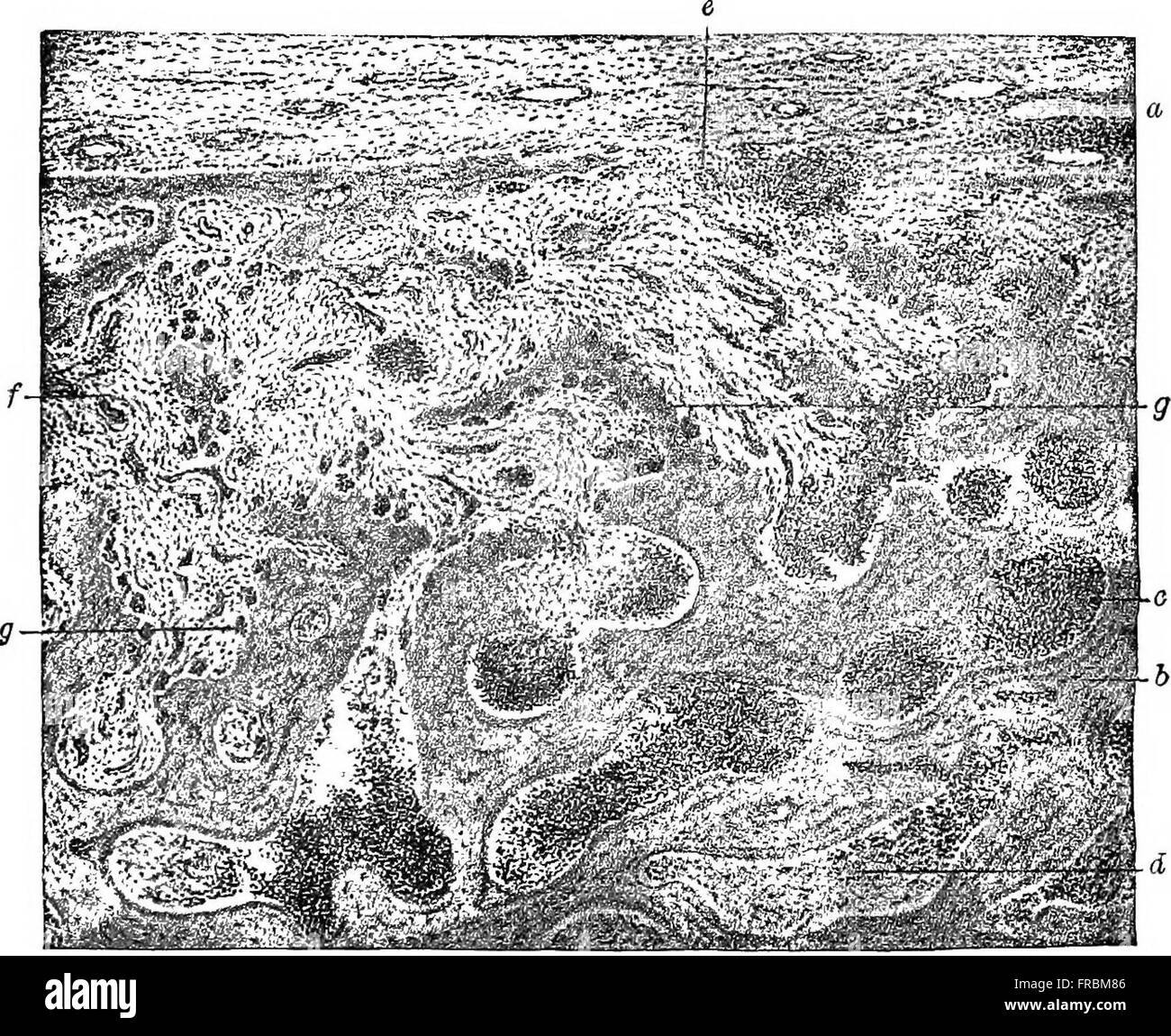 "Patologia generale" (1921) è un testo medico completo che copre un'ampia gamma di malattie, cause, sintomi e trattamenti, basato sull'undicesima edizione tedesca rivista, che offre approfondimenti approfonditi sulle condizioni patologiche. Foto Stock