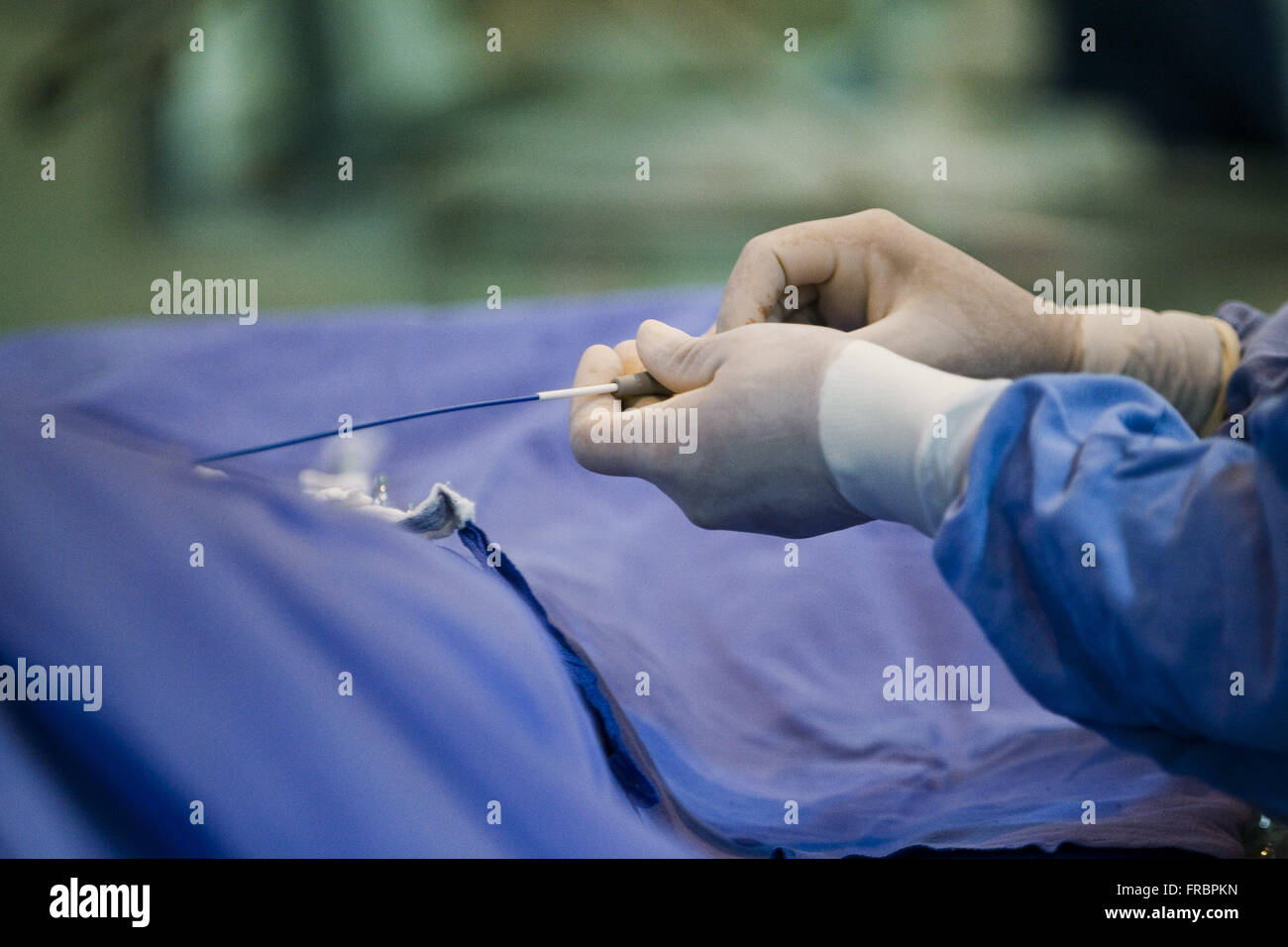 Realizzazione di angioplastica tecnica in maniera emodinamica ospedale centro chirurgico Foto Stock