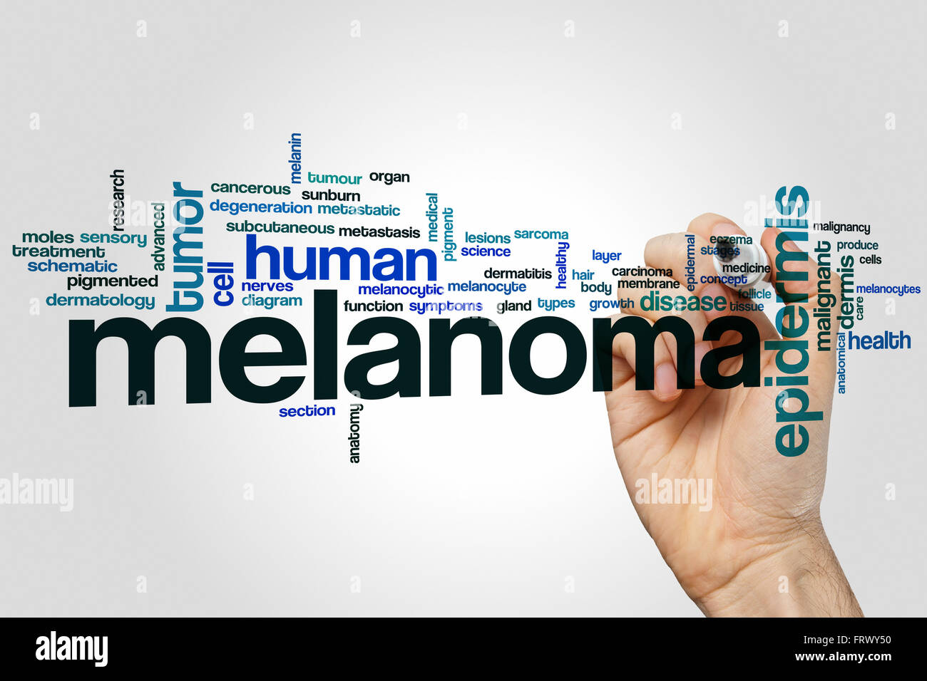 Il melanoma parola concetto di cloud Foto Stock