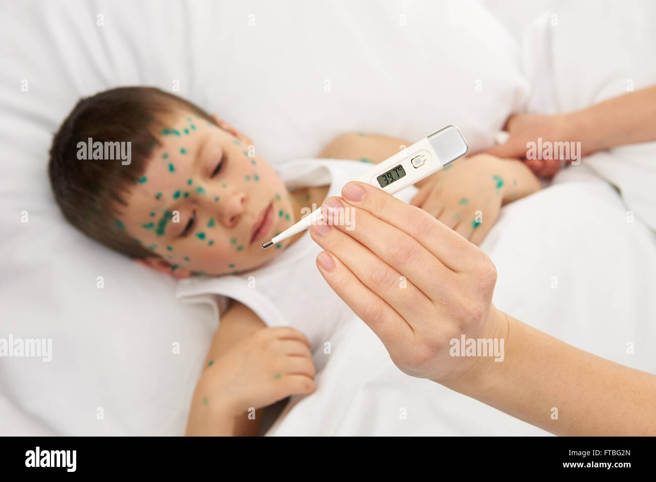 Bambino malato nel letto ha il virus sulla pelle, madre la mano con il termometro a contatto con la fronte Foto Stock