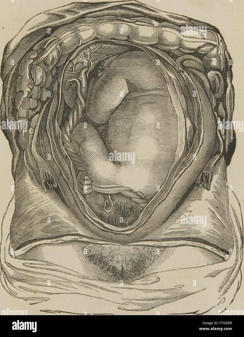 Santo Protettore Degli Organi Genitali Femminili