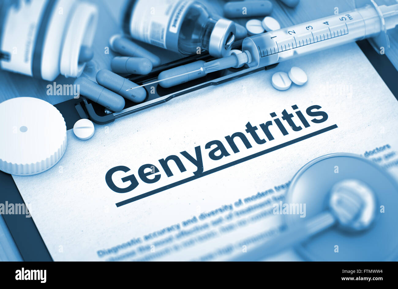 Genyantritis. Concetto medico. Foto Stock