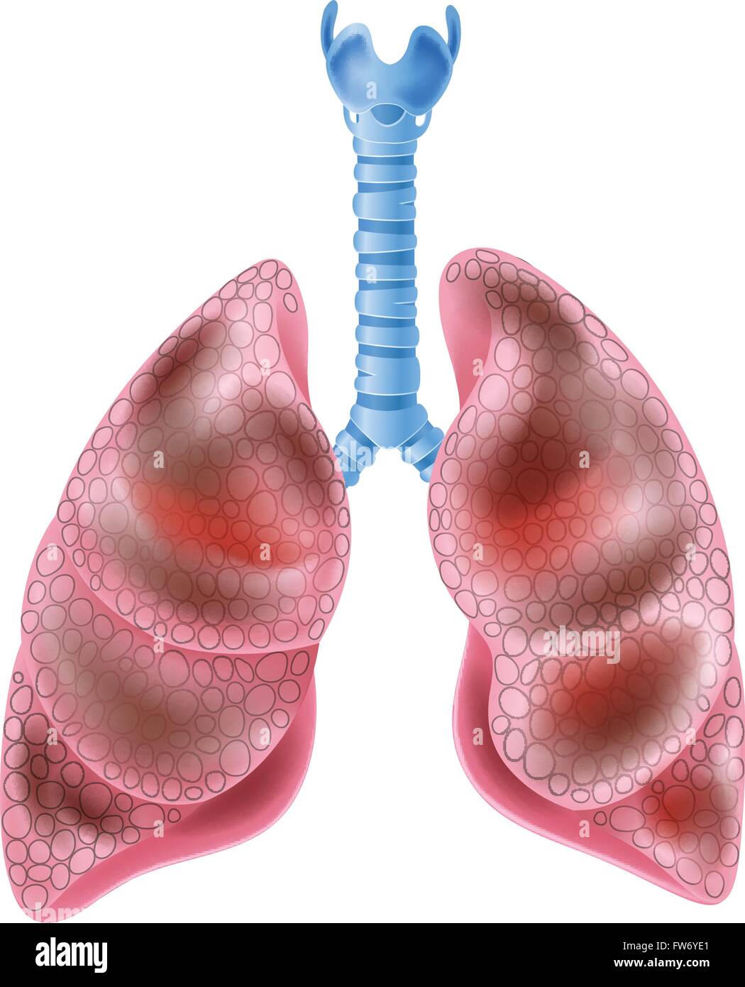 Illustrazione dei fumatori polmoni Illustrazione Vettoriale