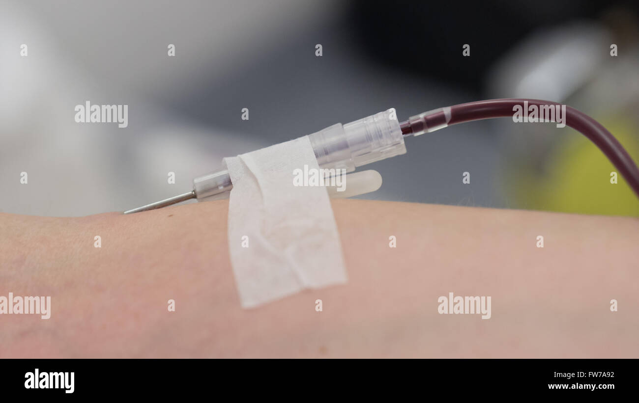 Donatore in una poltrona dona il sangue alla stazione hemotransfusion, close-up Foto Stock