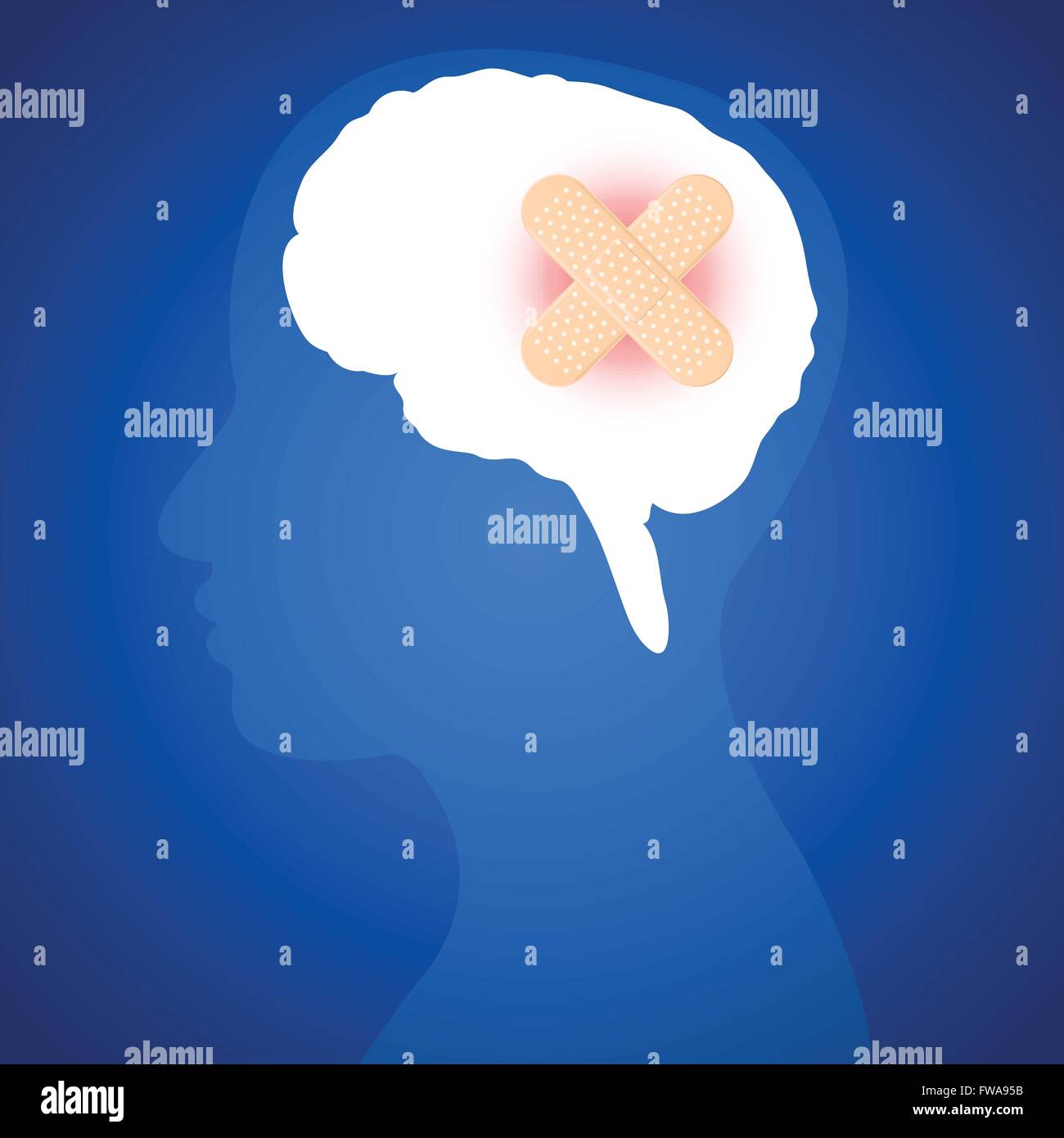 Le lesioni cerebrali su uno sfondo blu. Illustrazione. Illustrazione Vettoriale