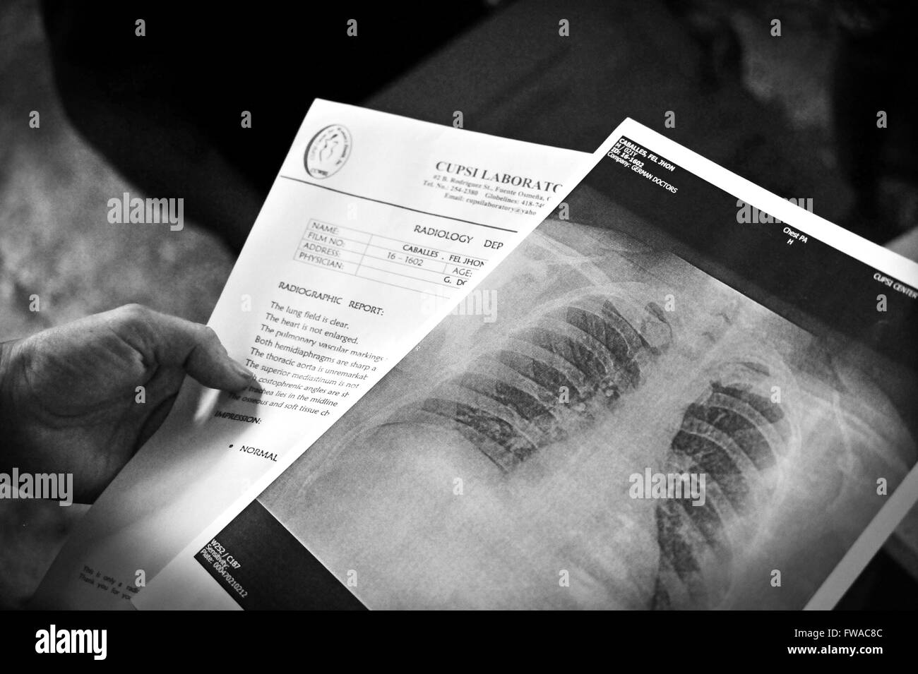 La Ong medici tedeschi al lavoro di Cebu City, Filippine. Solo uso editoriale. Foto Stock