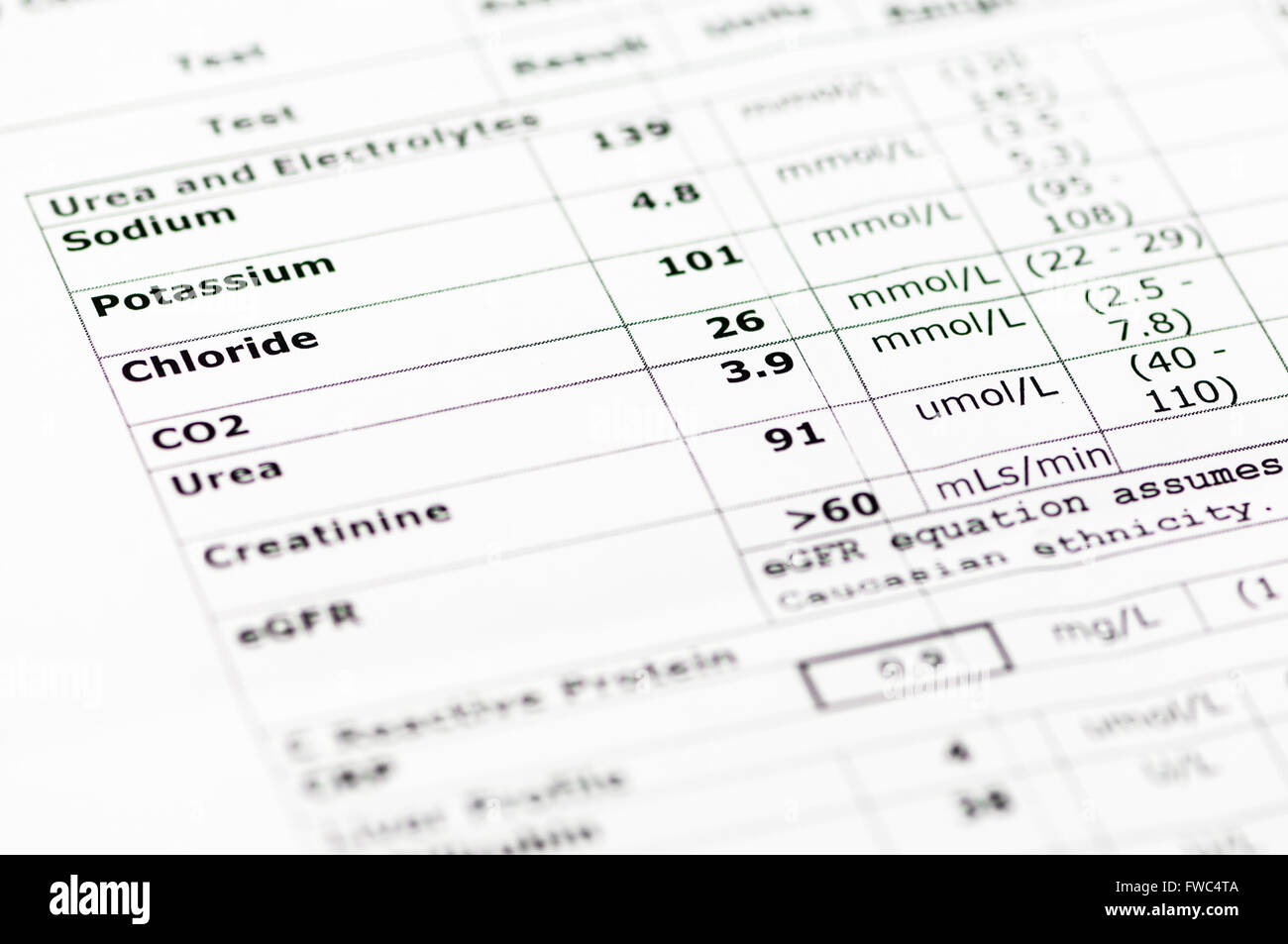 Chimica del sangue resoconto che mostra il normale urea e livelli elettrolito (sodio, potassio cloruro, anidride carbonica, urea, creatinin Foto Stock