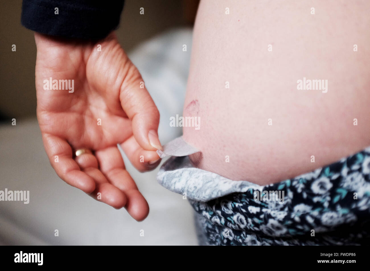 Donna di mezza età utilizzando Evorel Conti HRT patch per aiutare con la menopausa terapia ormonale sostitutiva Trattamento Foto Stock