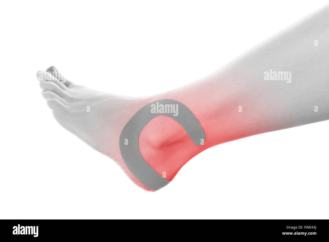 Tape terapeutico sulla caviglia femmina isolati su sfondo bianco. Il dolore cronico, medicina alternativa. Riabilitazione fisioterapia Foto Stock