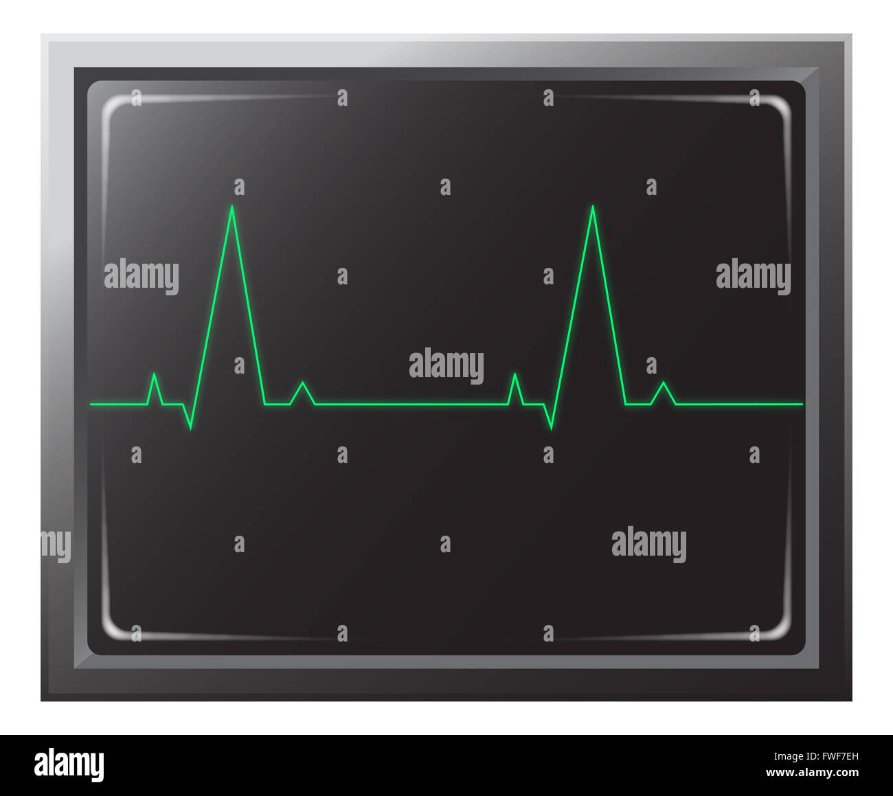 Un monitor per la frequenza cardiaca con 2 bip isolato su uno sfondo bianco Foto Stock