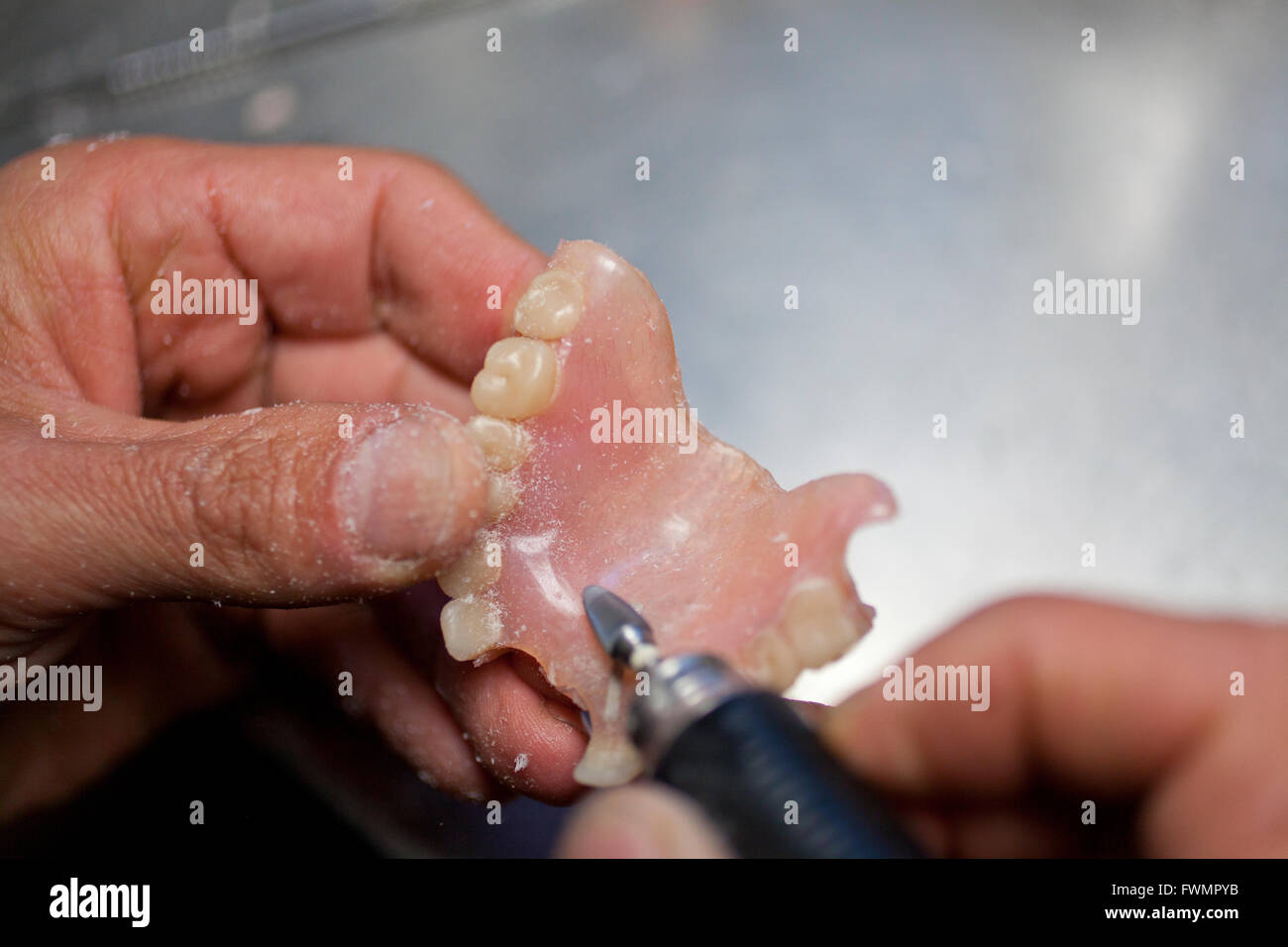 Artificiale di riparazione dei denti umani Foto Stock
