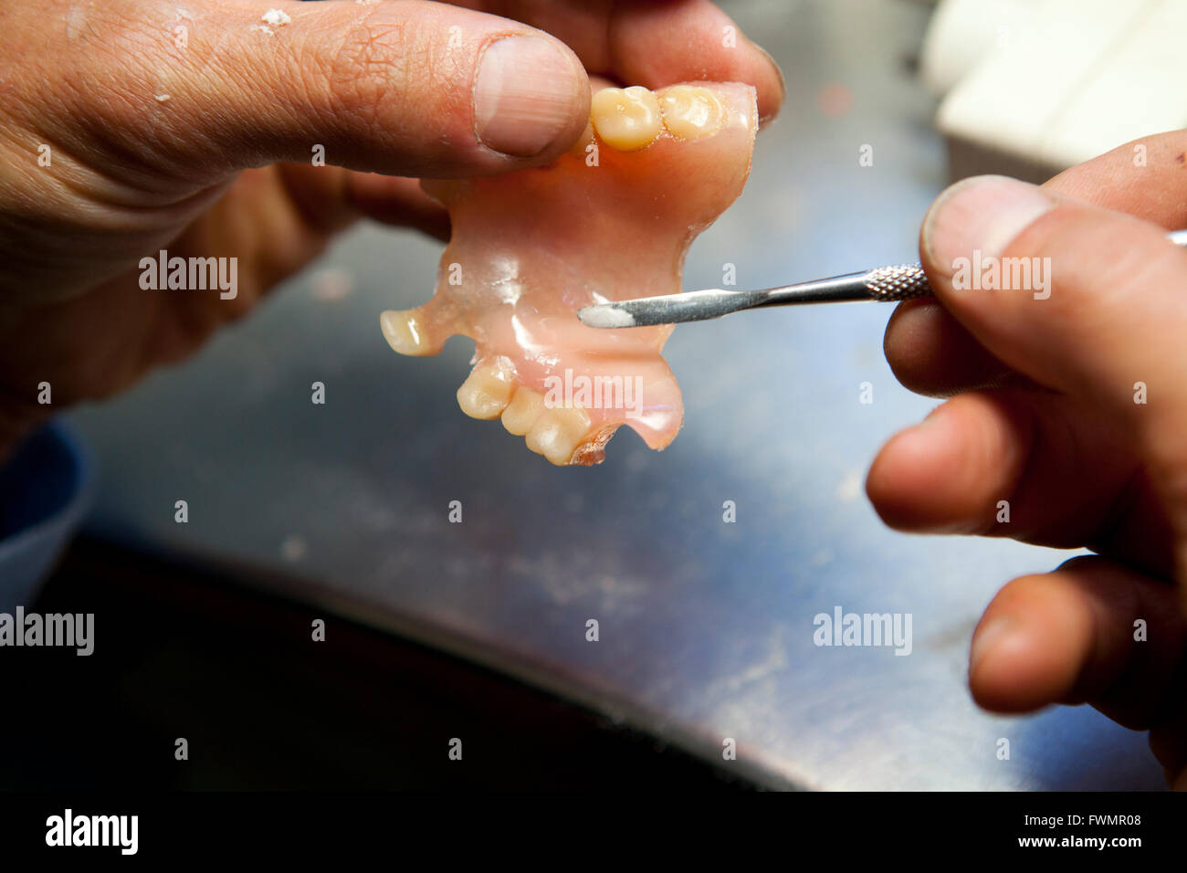 Artificiale di riparazione dei denti umani Foto Stock