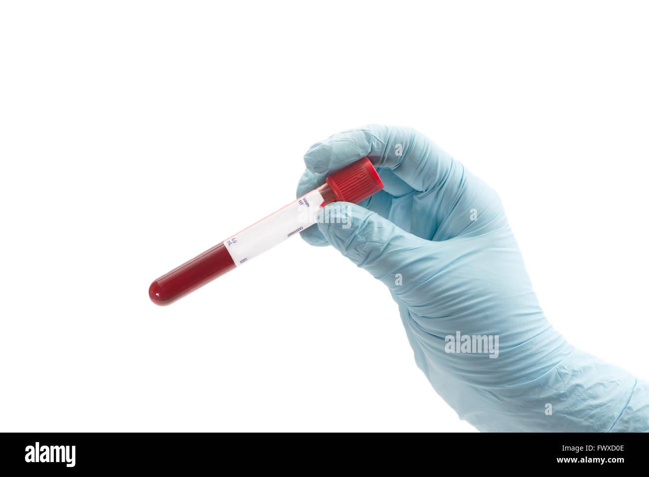 Il prelievo del campione di sangue tubo trattenuto dalla mano. Foto Stock