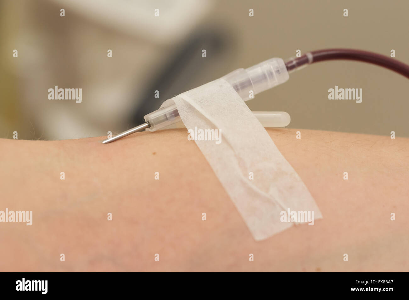 Donatore in una poltrona dona il sangue alla stazione hemotransfusion, close-up Foto Stock