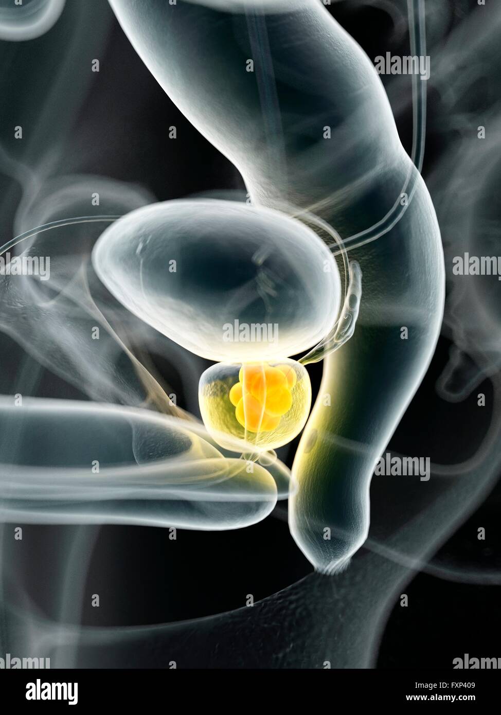 Cancro umano della prostata, illustrazione del computer. Foto Stock