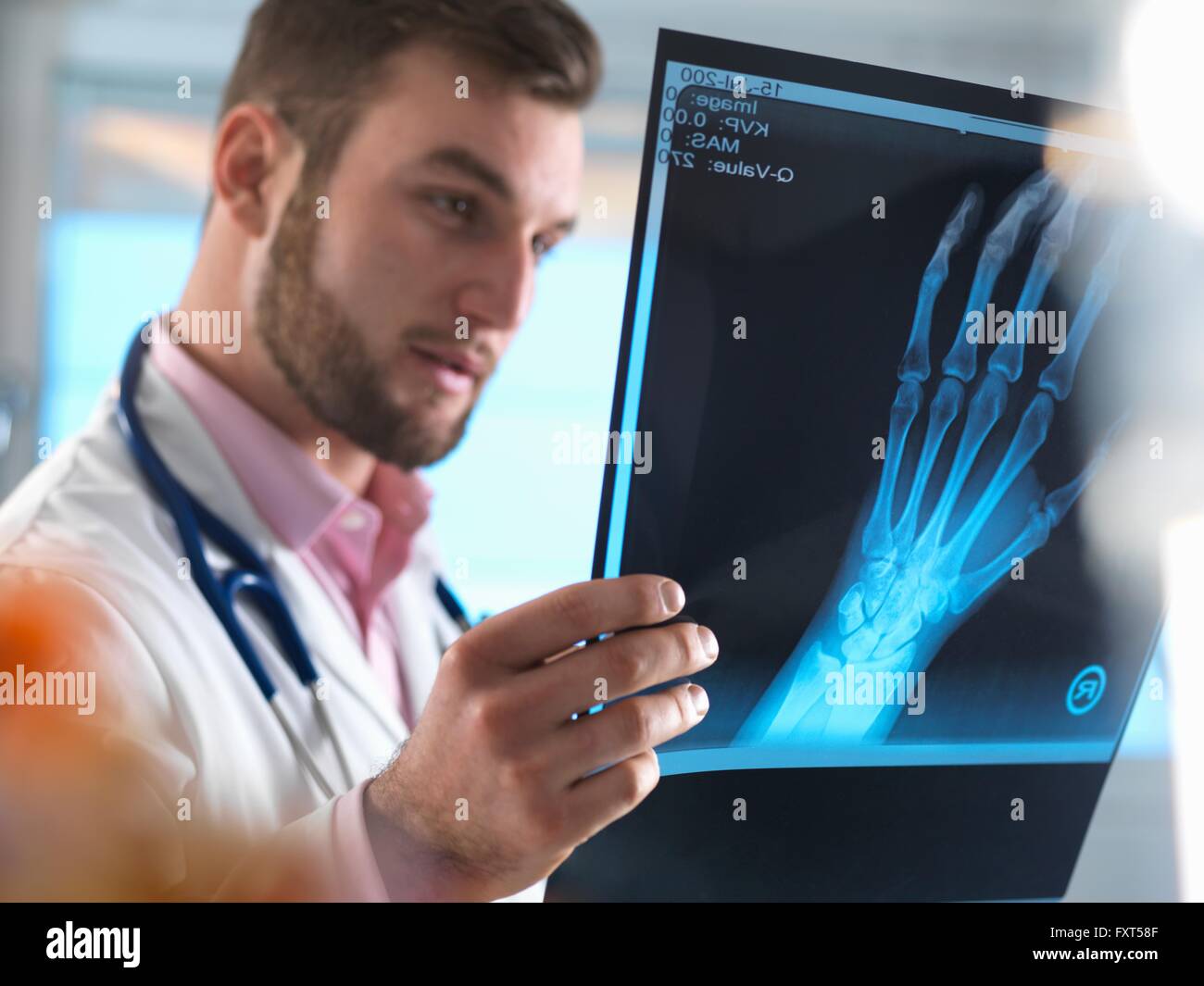 Junior medico esame x-ray di mano fratturata in ospedale Foto Stock