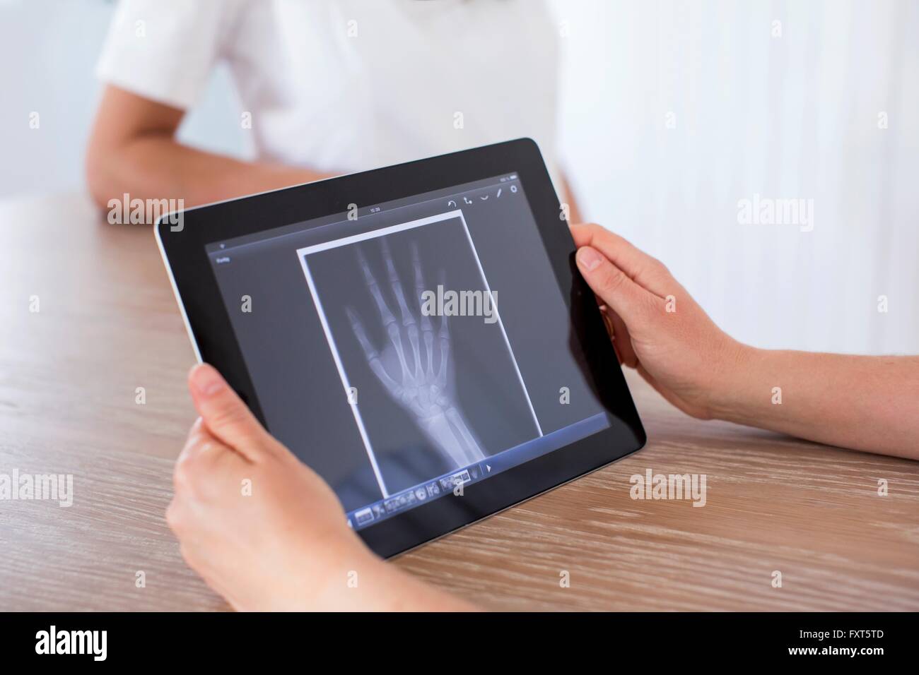 Donna che mantiene tavoletta digitale con immagine a raggi x di mano sullo schermo Foto Stock
