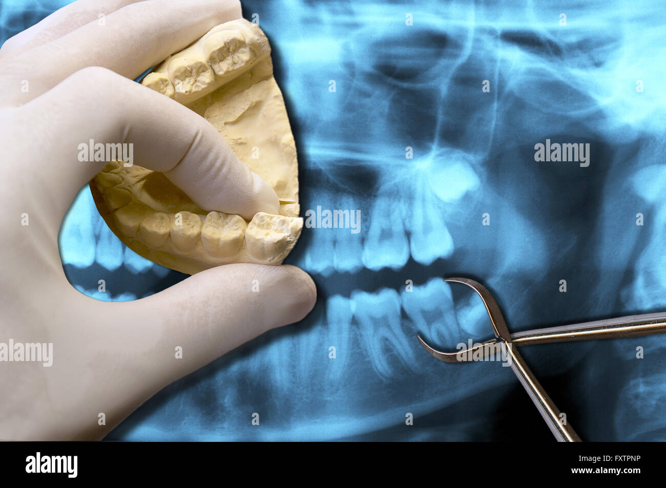 Dentista mostra dente molare su radiografia Foto Stock