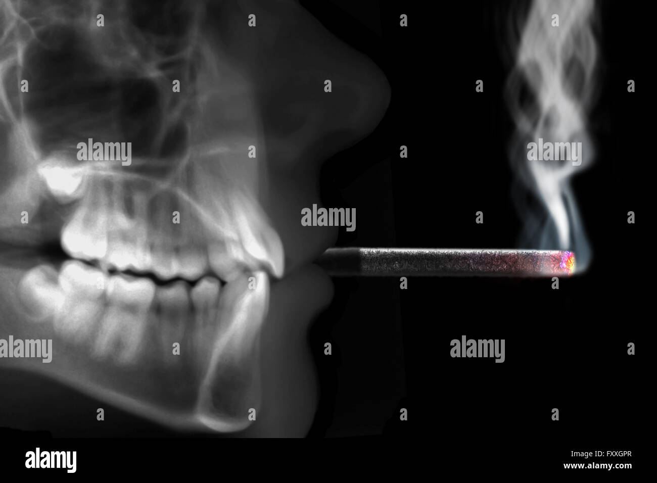Radiografia umana Sigaretta fumare con fumo Foto Stock