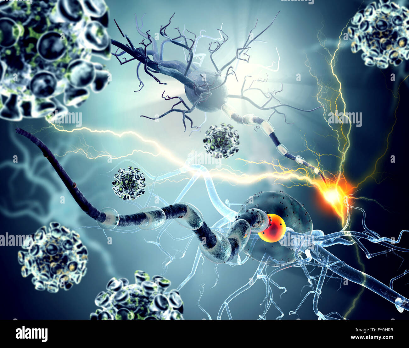 Le cellule nervose, concetto per malattie neurologiche, tumori e chirurgia cerebrale. Foto Stock