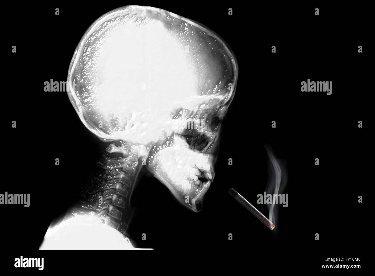 Radiografia Sigaretta fumare Foto Stock