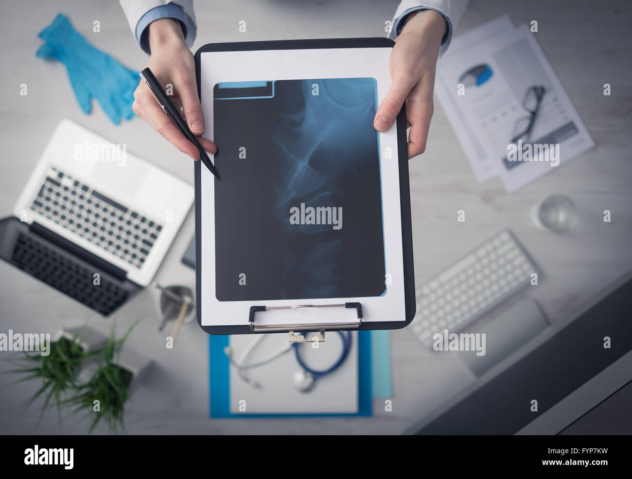 Radiologo cheching un'immagine a raggi x della colonna vertebrale umana, mani e appunti da vicino con il desktop su sfondo, vista dall'alto Foto Stock