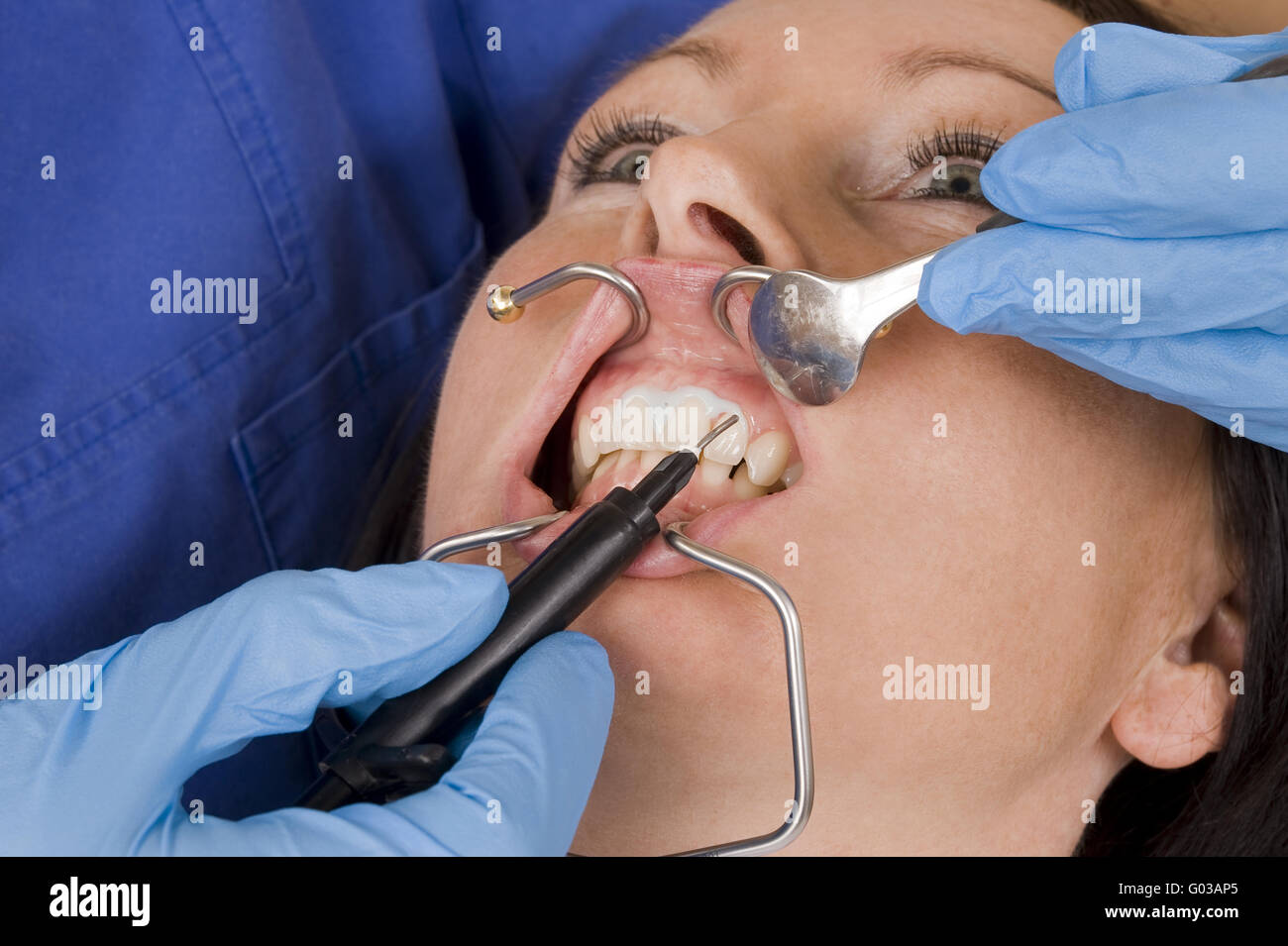 dentista Foto Stock