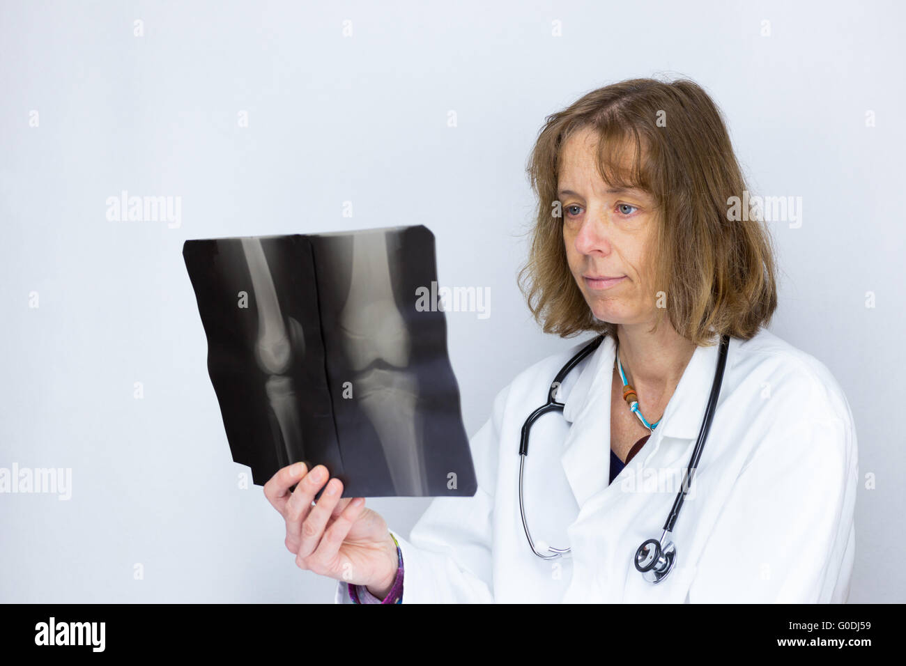 Femmina olandese medico guardando a raggi X foto Foto Stock