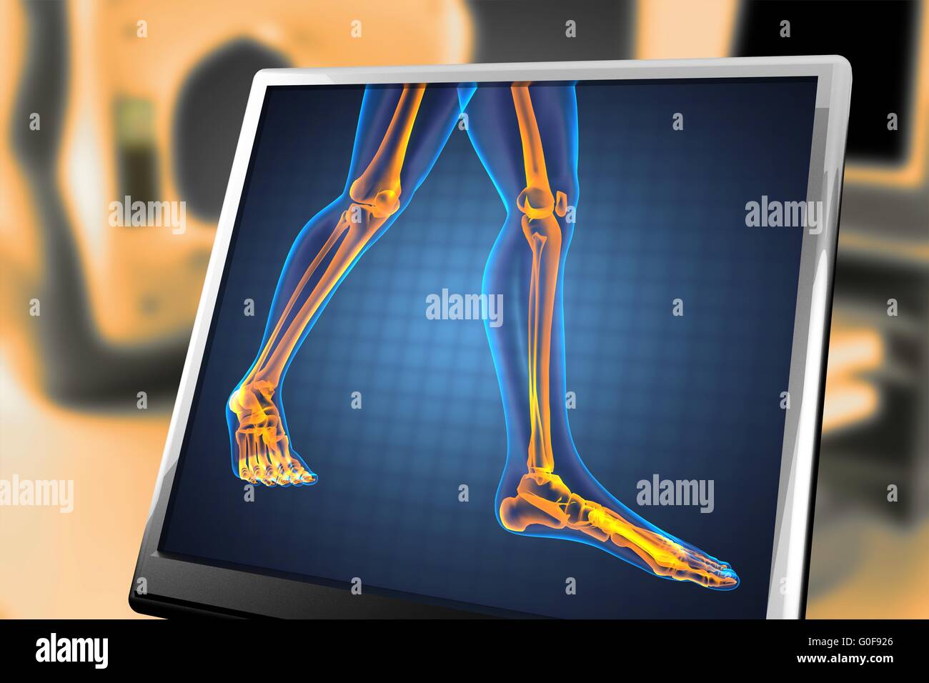 Radiografia umana scan Foto Stock
