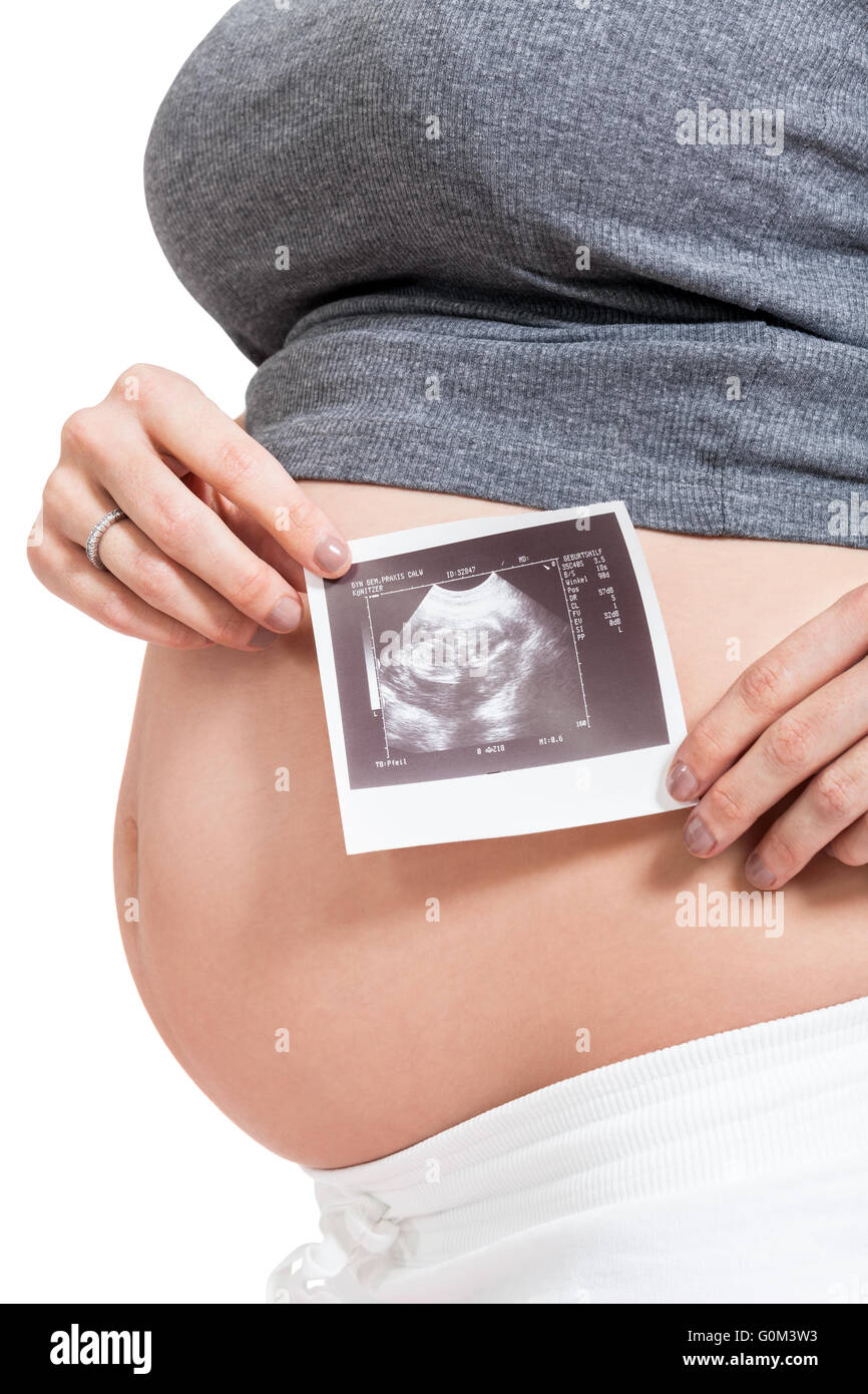 Donna incinta visualizzando una ecografia prenatale Foto Stock