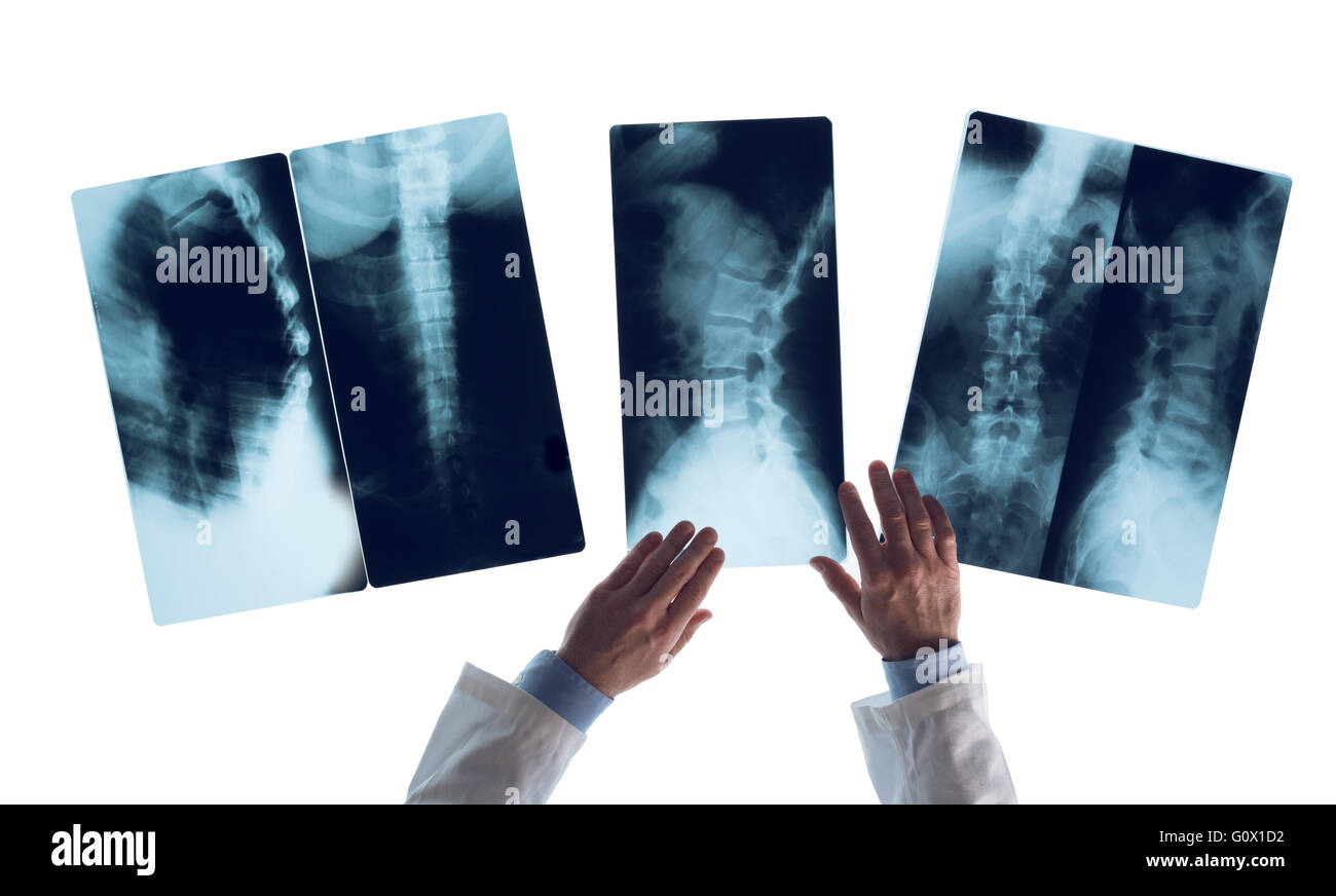 Il controllo da parte del radiologo di esami di un'immagine a raggi x su una vista light box, irriconoscibile la persona, assistenza medica e il concetto di assistenza sanitaria Foto Stock Il controllo da parte del radiologo di esami di un'immagine a raggi x su una vista light box, irriconoscibile la persona, assistenza medica e il concetto di assistenza sanitaria Foto Stock