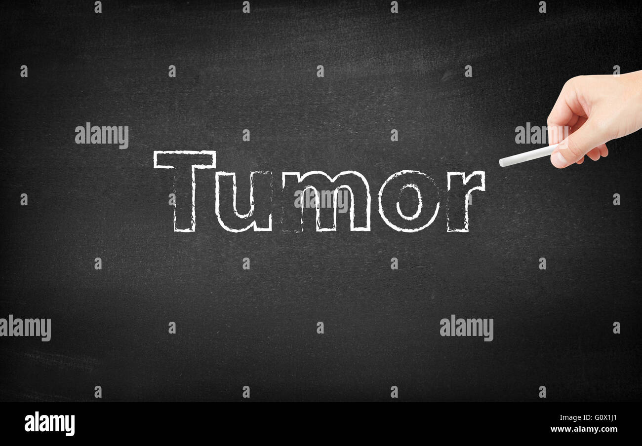 Tumore scritti su una lavagna Foto Stock