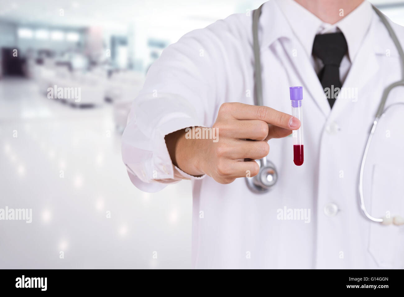 In prossimità di una prova medica di vetro con il sangue con medico Foto Stock