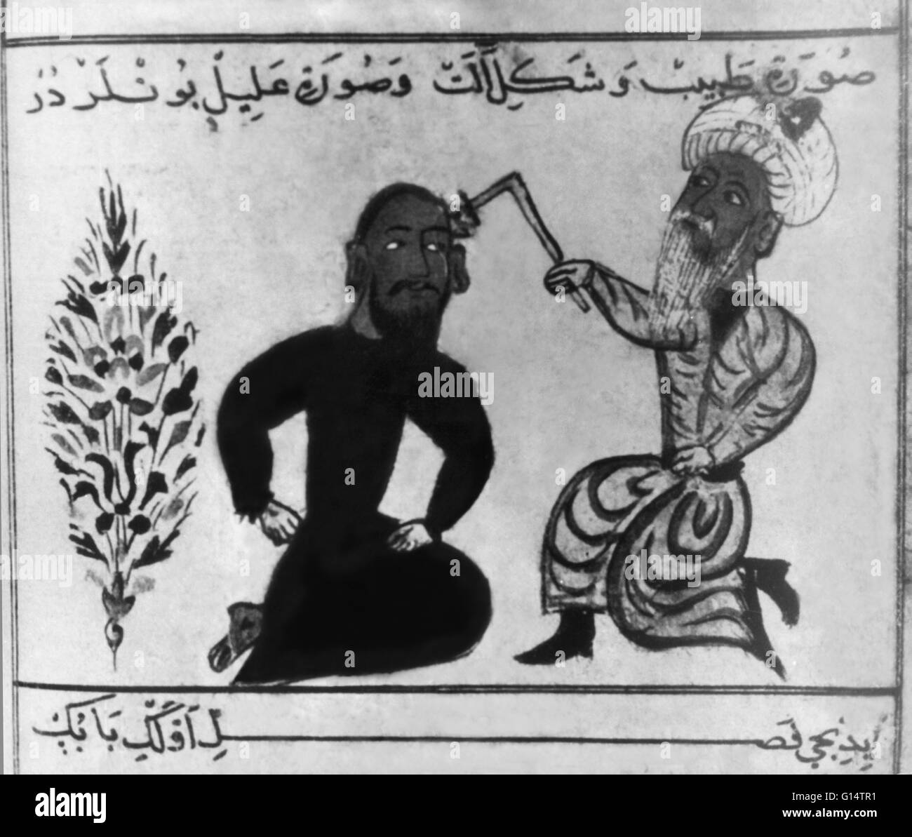 Manoscritto persiano pagina che mostra un medico cauterizzare una ferita con un rosso ferro caldo. Foto Stock