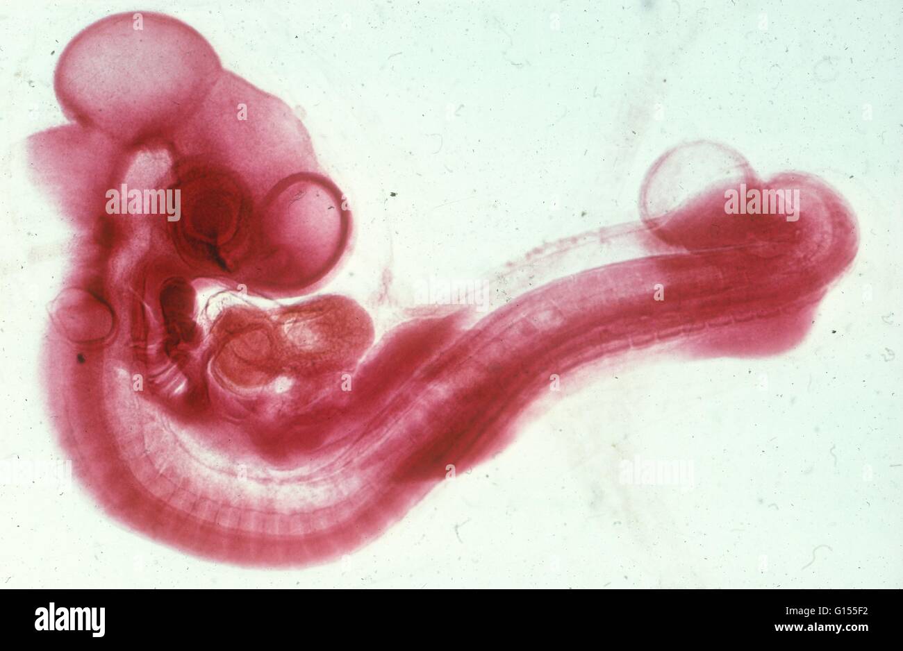 Micrografia di Luce che mostra il progresso del pulcino di sviluppo; 72 ore di incubazione. 10 in una serie di 13. Foto Stock
