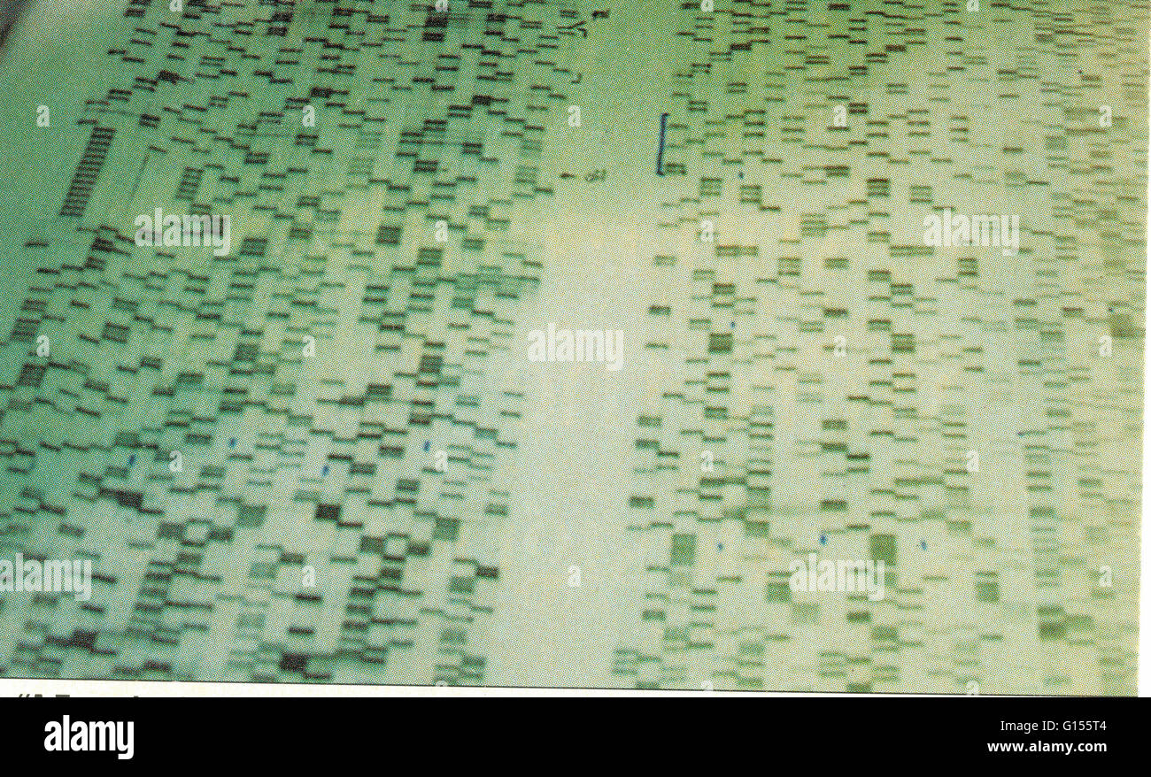 Il processo mediante il quale la sequenza di nucleotidi lungo un filamento di DNA è determinata. Originariamente un difficile processo di effettuare, il sequenziamento di DNA può ora essere fatto sistematicamente dalle macchine. Il completamento del progetto genoma umano nel 2000 ha prodotto il più grande Foto Stock