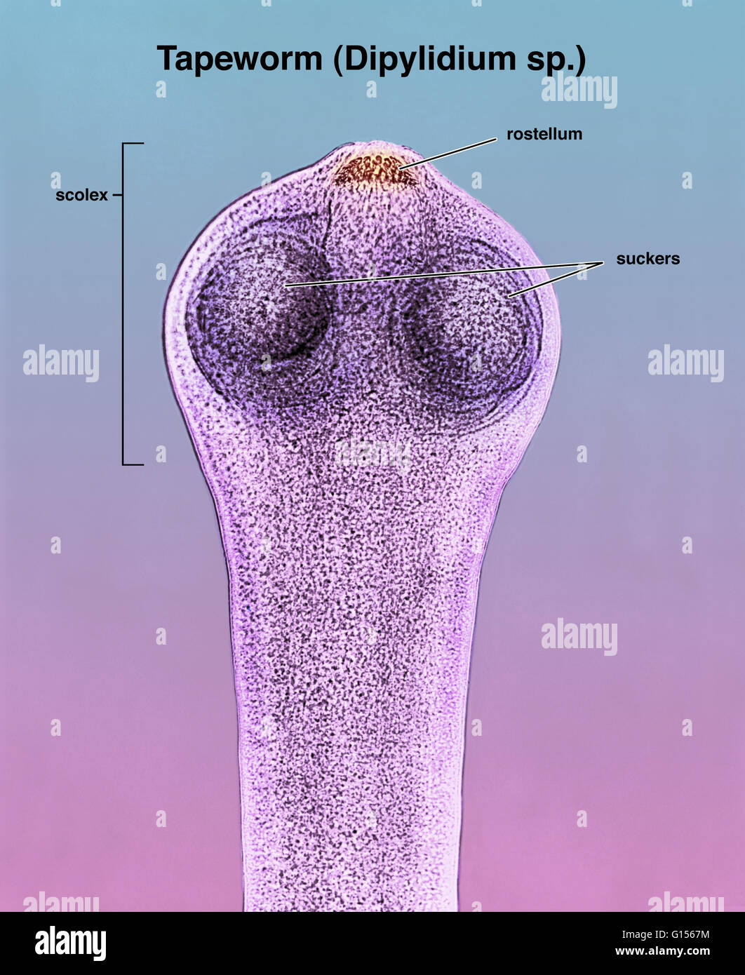 Micrografia luce del scolex (testa) di una tenia Dipylidium (sp). Il rostellum (in giallo) ha quattro file di ganci che, insieme con i quattro ventose (in blu), collegare l'scolex della tenia alla parete intestinale del suo ospite. Una infografica, con la Foto Stock