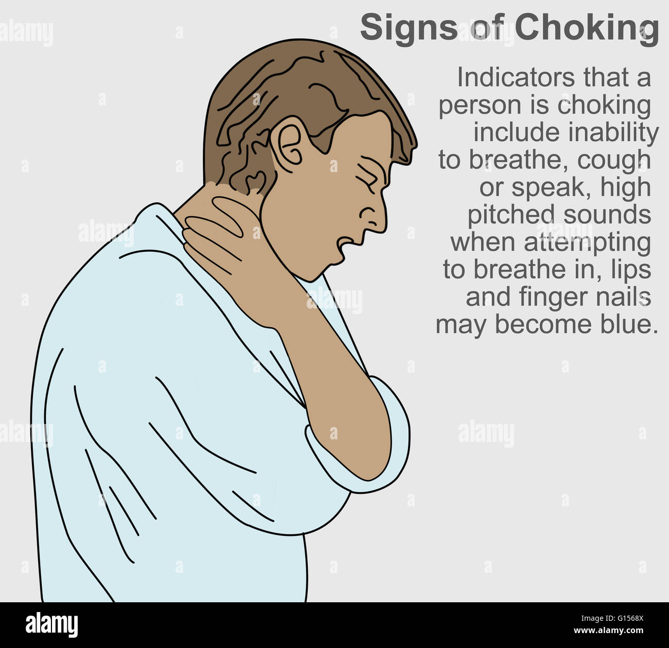 Un primo aiuto illustrazione che mostra segni di soffocamento. Indicatori includono: l'incapacità di respirare, tosse o parlare; acuto di suoni quando si tenta di respirare; le labbra e le unghie eventualmente diventa blu. Foto Stock