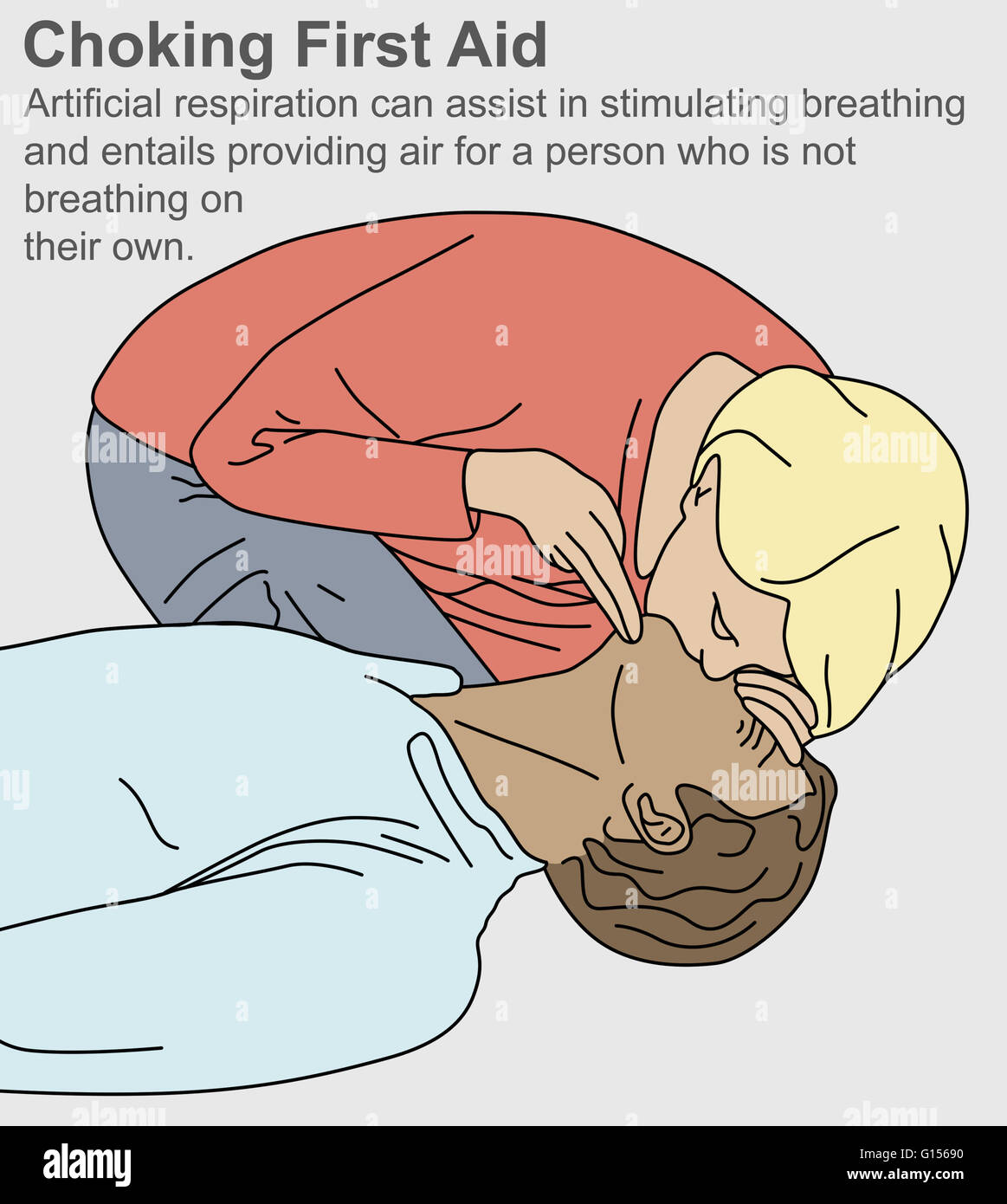 Un primo aiuto illustrazione su come aiutare una persona che è soffocamento. La respirazione artificiale (bocca a bocca) può aiutare a stimolare la respirazione. Foto Stock
