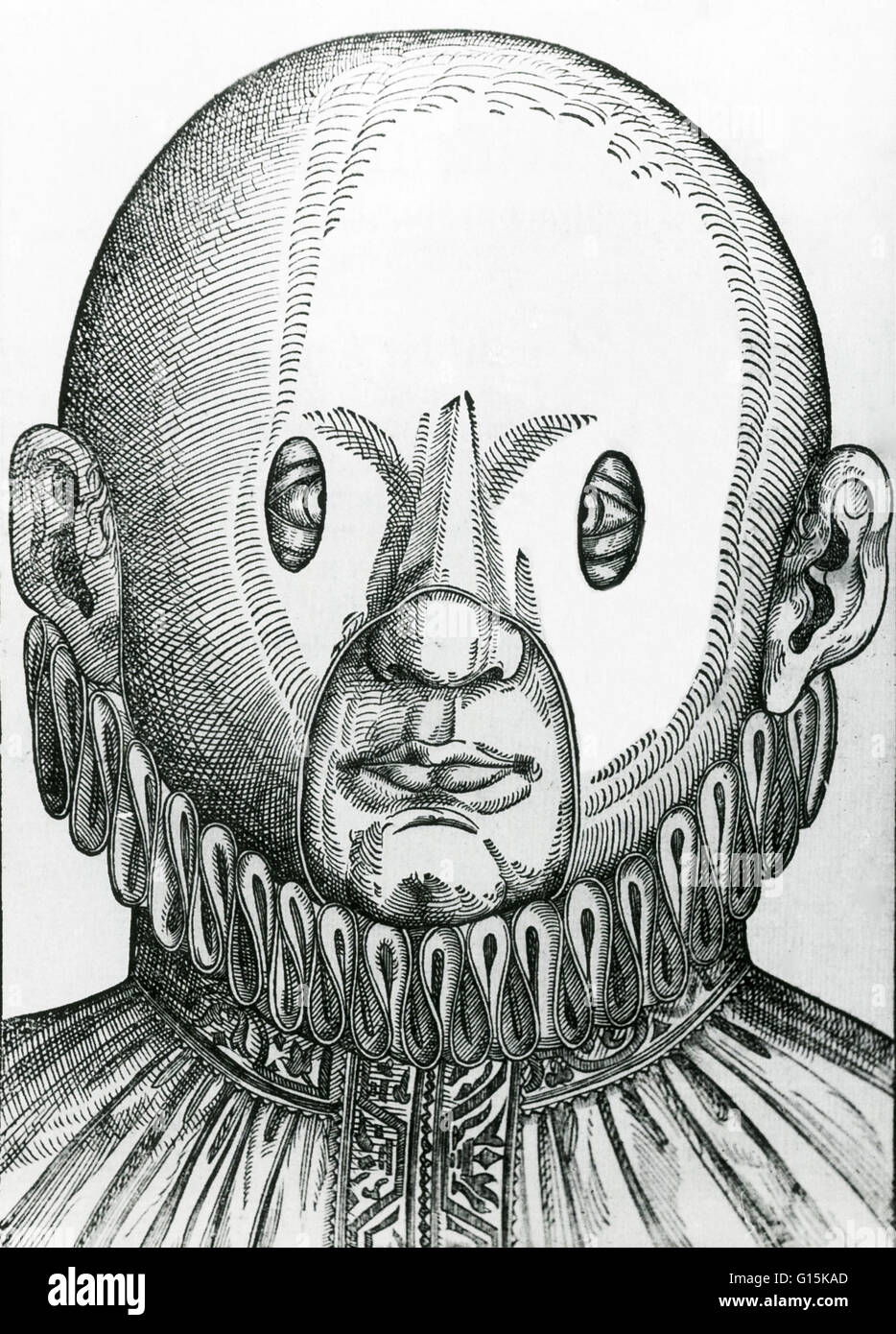 Una maschera per correggere gli occhi incrociati, dal 1583. La maschera è stata sviluppata da Georg Bartisch (1535-1606), che era nato un contadino vicino a Dresda, Germania. Sebbene egli non era sufficientemente ricca di perseguire la formazione formale in medicina, divenne un successo barbiere di sovratensione Foto Stock
