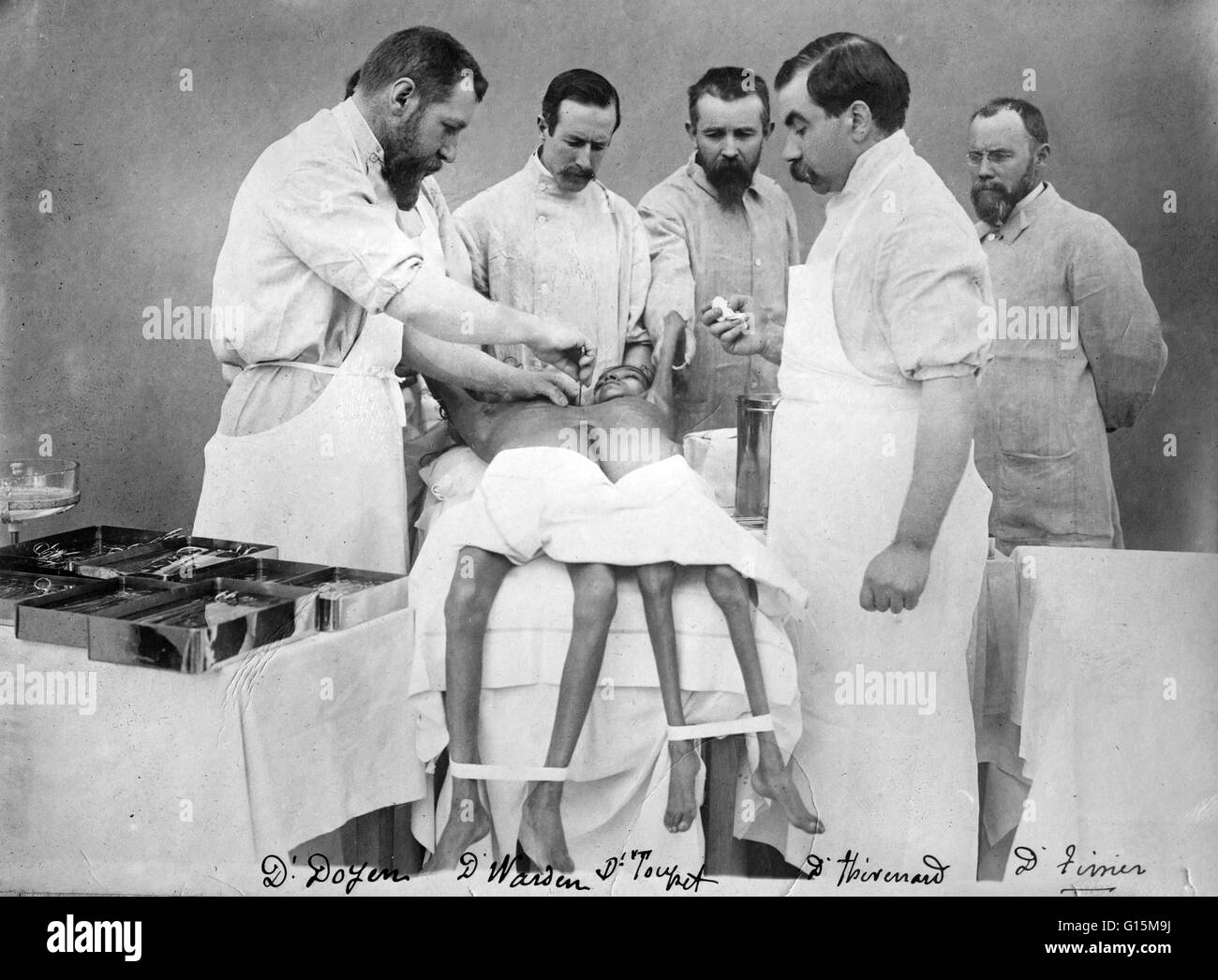 Eugène-Louis Doyen (16 dicembre 1859 - 21 novembre 1916) era un chirurgo francese. Doyen era un esperto e innovativo medico. Egli è stato un pioniere nell'uso di elettrobisturi e elettrocoagulazione. Egli aveva un vivo interesse per la fotografia e la cinematografia, Foto Stock