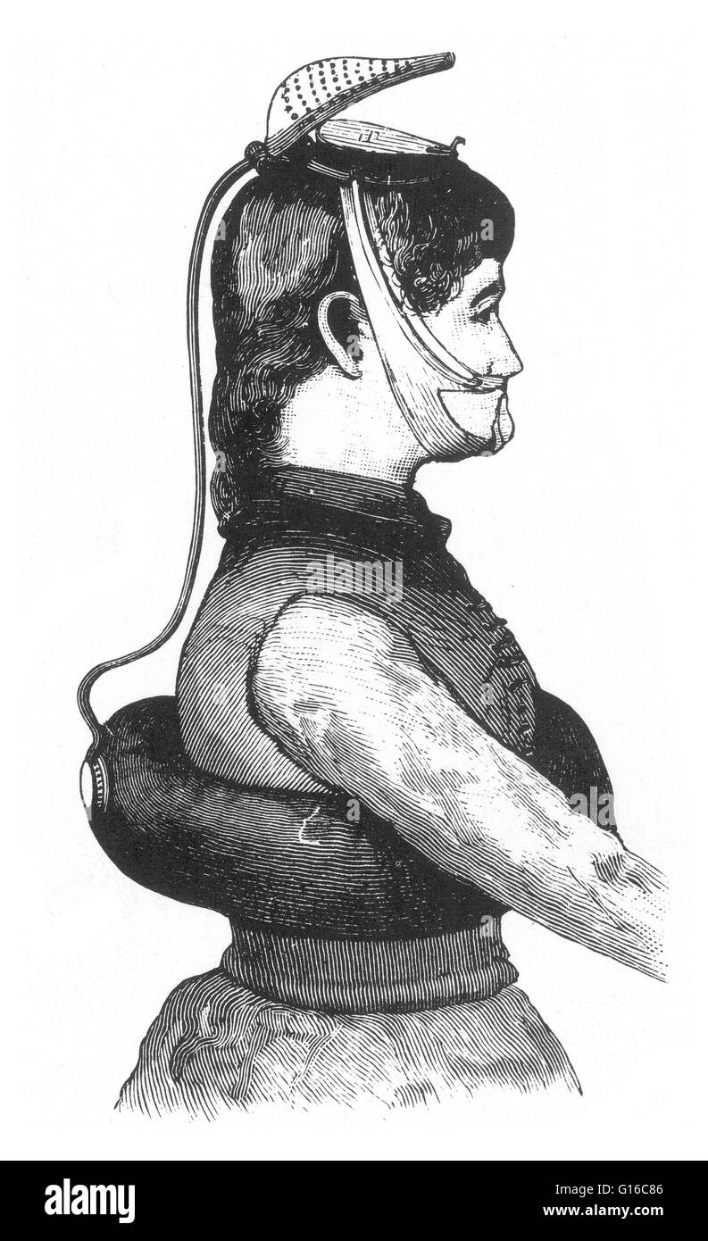 L'aria-catcher attaccata alla testa della donna le permettesse di respirare di circa dieci centimetri maggiore la sua bocca. Un personale dispositivo di galleggiamento è pezzo di apparecchiature progettate per assistere a un utilizzatore, che può essere sia cosciente o incosciente, per mantenere a galla. Foto Stock