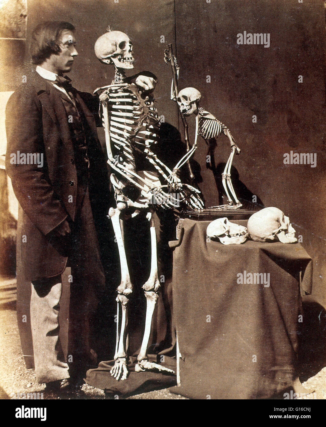 In scena il ritratto di Southey con scheletri di umane e di scimmia prese da Dodgson. Reginald Southey (15 settembre 1835 - 8 novembre 1899) era un medico inglese e inventore di Southey la cannula o tubo, un tipo di trequarti impiegato per il drenaggio di edema della li Foto Stock