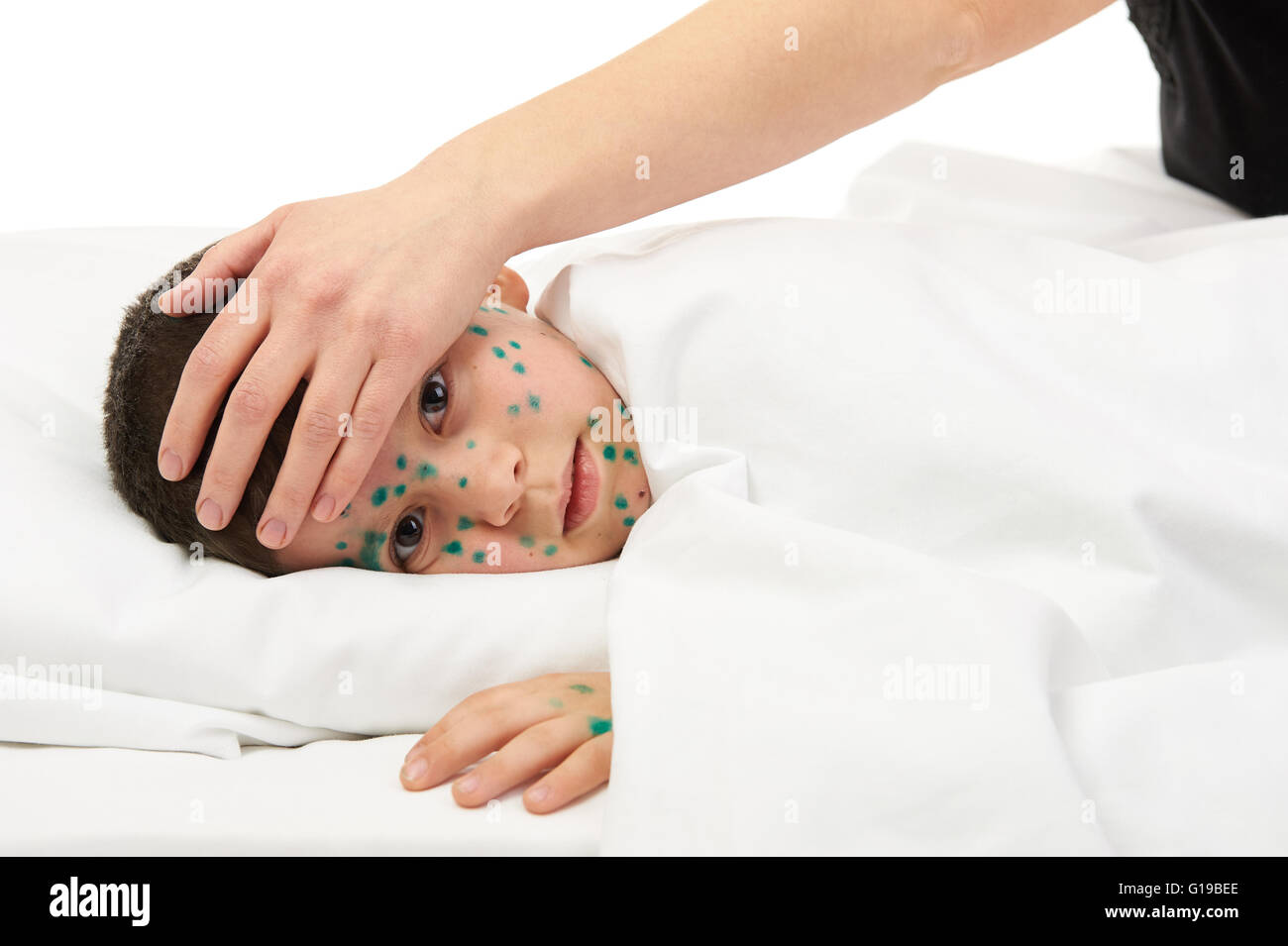 Bambino malato ha il virus sulla pelle, madre la mano tocca la fronte Foto Stock