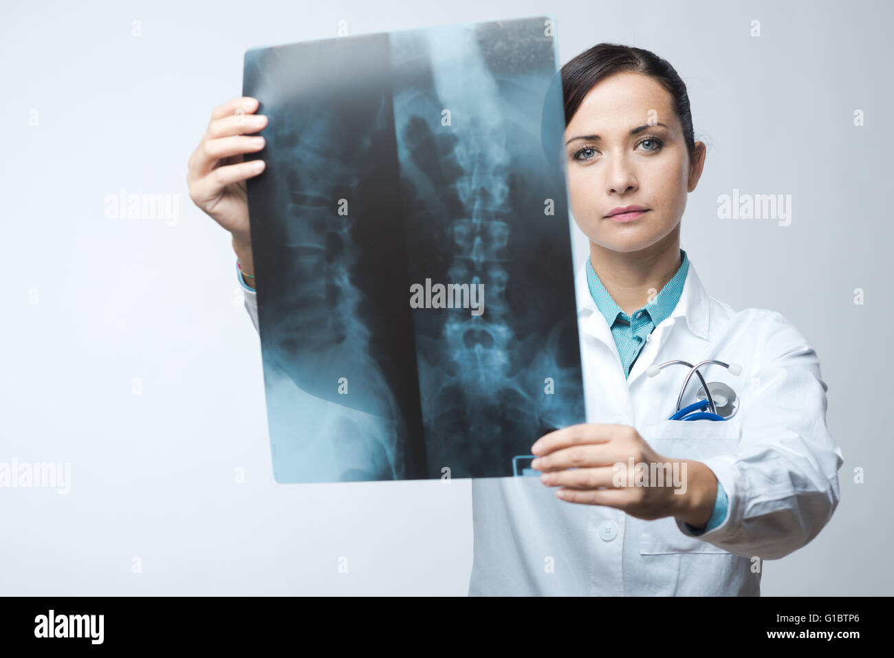 Fiducioso femmina di controllo da parte del radiologo di esami di immagine a raggi x della colonna vertebrale. Foto Stock