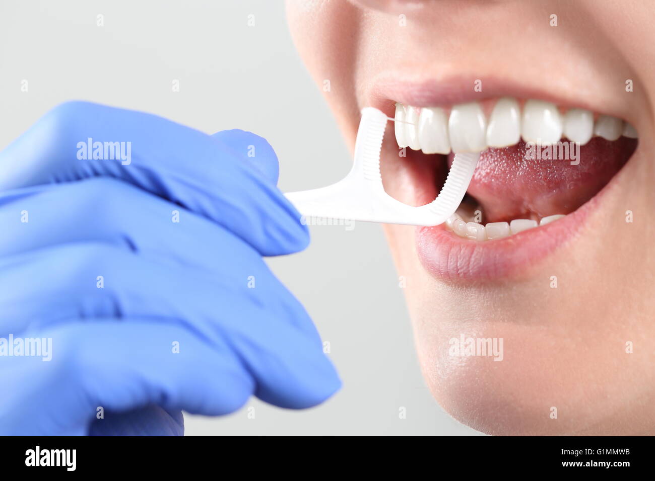 Professional profonda pulizia dei denti il filo interdentale Foto Stock
