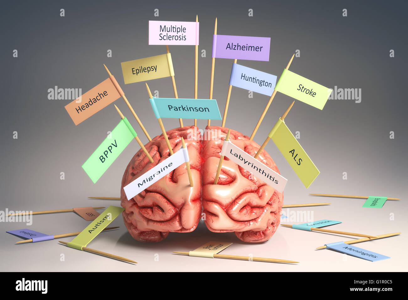 Immagine di un cervello sulla tavola con varie targhette di varie malattie che possono influenzare il nostro cervello. Si tratta di una immagine 3D con namepl Foto Stock