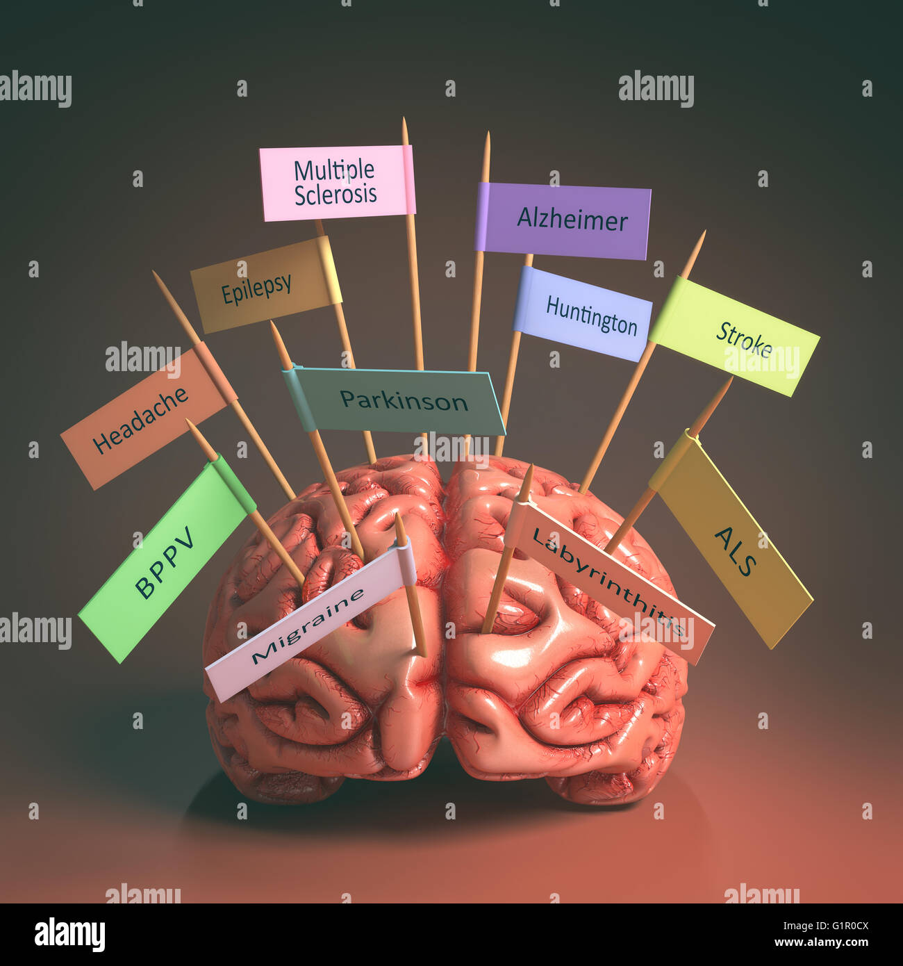 Immagine di un cervello sulla tavola con varie targhette di varie malattie che possono influenzare il nostro cervello. Si tratta di una immagine 3D con namepl Foto Stock