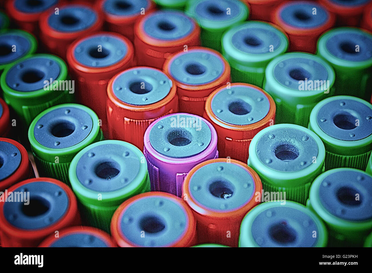 Close up medical provetta con i campioni di sangue Foto Stock