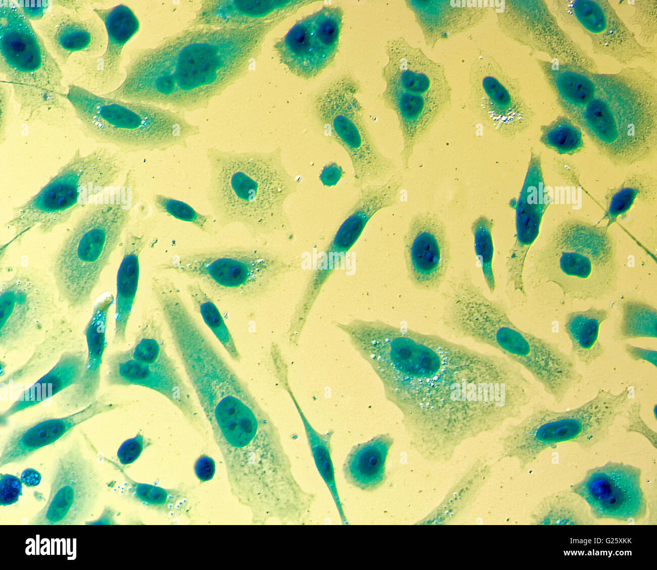 Umana PC-3 di cellule di cancro della prostata, colorati con blu Coomassie, sotto differencial interference contrast microscopio. Foto Stock